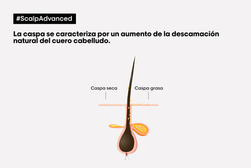 Scalp Advanced champú anticaspa - Los virales del momento | L'Oréal Partner Shop