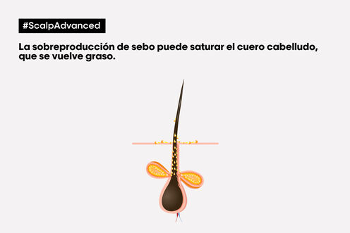 Scalp Advanced champú anti grasa - Los virales del momento | L'Oréal Partner Shop