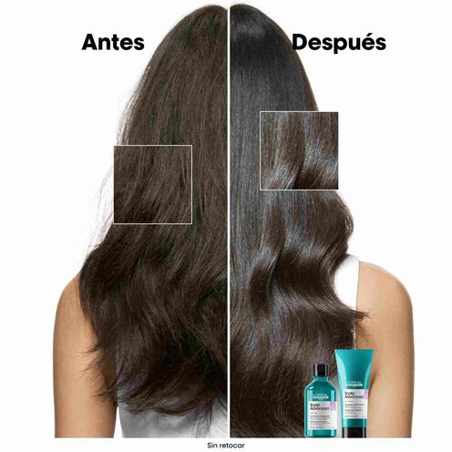 Scalp Advanced champú anti malestar - L'Oréal Professionnel | L'Oréal Partner Shop