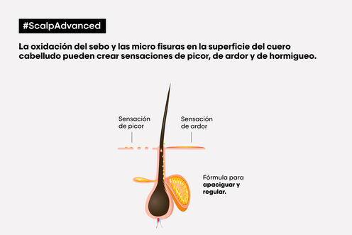 Scalp Advanced champú anti malestar - Los virales del momento | L'Oréal Partner Shop