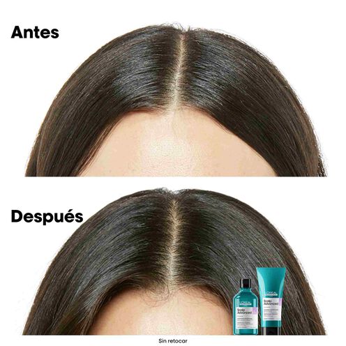 Scalp Advanced champú anti malestar - L'Oréal Professionnel | L'Oréal Partner Shop